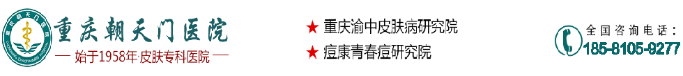 重庆有名皮肤科医院-重庆皮肤专科医院-重庆朝天门医院皮肤科可以吗
